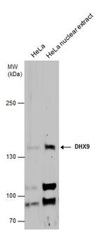 DHX9 Antibody in Western Blot (WB)