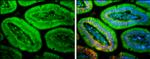 PLEKHA7 Antibody in Immunohistochemistry (Paraffin) (IHC (P))