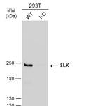 SLK Antibody in Western Blot (WB)