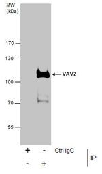 VAV2 Antibody in Immunoprecipitation (IP)