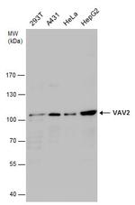 VAV2 Antibody in Western Blot (WB)