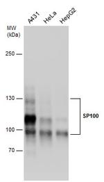 SP100 Antibody in Western Blot (WB)