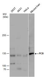 Pyruvate Carboxylase Antibody in Western Blot (WB)