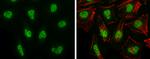 BRG1 Antibody in Immunocytochemistry (ICC/IF)