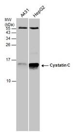 Cystatin C Antibody in Western Blot (WB)