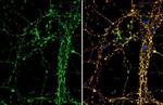 BDNF Antibody in Immunocytochemistry (ICC/IF)