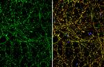 BDNF Antibody in Immunocytochemistry (ICC/IF)