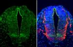 OLIG2 Antibody in Immunohistochemistry (Paraffin) (IHC (P))