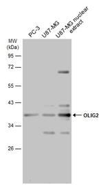 OLIG2 Antibody in Western Blot (WB)