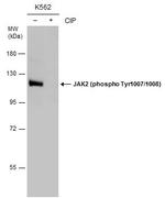 Phospho-JAK2 (Tyr1007, Tyr1008) Antibody in Western Blot (WB)