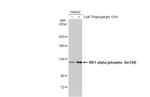 Phospho-IRE1 alpha (Ser724) Antibody in Western Blot (WB)