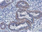 Phospho-EGFR (Tyr1068) Antibody in Immunohistochemistry (Paraffin) (IHC (P))