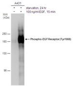 Phospho-EGFR (Tyr1068) Antibody in Western Blot (WB)