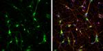 CaMKII beta Antibody in Immunocytochemistry (ICC/IF)