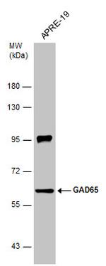 GAD65 Antibody in Western Blot (WB)