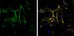 MAP2 Antibody in Immunocytochemistry (ICC/IF)