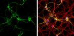 MAP2 Antibody in Immunocytochemistry (ICC/IF)