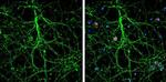 Nestin Antibody in Immunocytochemistry (ICC/IF)