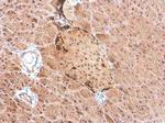 Somatostatin Antibody in Immunohistochemistry (Paraffin) (IHC (P))