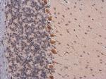 Somatostatin Antibody in Immunohistochemistry (Paraffin) (IHC (P))