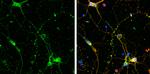 SHANK3 Antibody in Immunocytochemistry (ICC/IF)