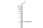 NPY Antibody in Western Blot (WB)