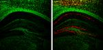 NEFM Antibody in Immunohistochemistry (Frozen) (IHC (F))