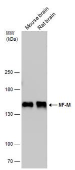 NEFM Antibody in Western Blot (WB)