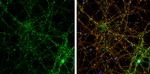 PSD-95 Antibody in Immunocytochemistry (ICC/IF)