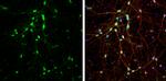 DARPP-32 Antibody in Immunocytochemistry (ICC/IF)