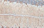 DARPP-32 Antibody in Immunohistochemistry (Paraffin) (IHC (P))