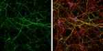 alpha Internexin Antibody in Immunocytochemistry (ICC/IF)