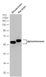 alpha Internexin Antibody in Western Blot (WB)