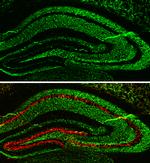 alpha Synuclein Antibody in Immunohistochemistry (Frozen) (IHC (F))