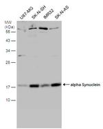 alpha Synuclein Antibody in Western Blot (WB)