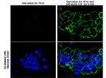 Phospho-EGFR (Tyr1148) Antibody in Immunocytochemistry (ICC/IF)