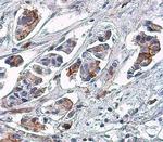 Phospho-EGFR (Tyr1148) Antibody in Immunohistochemistry (Paraffin) (IHC (P))