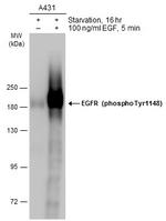 Phospho-EGFR (Tyr1148) Antibody in Western Blot (WB)