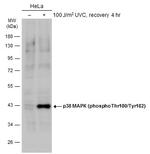 Phospho-p38 MAPK (Thr180, Tyr182) Antibody in Western Blot (WB)