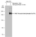 Phospho-PDGFRB (Tyr771) Antibody in Western Blot (WB)