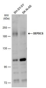 DEPDC5 Antibody in Western Blot (WB)