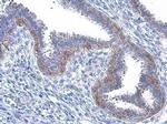 Phospho-EGFR (Tyr1086) Antibody in Immunohistochemistry (Paraffin) (IHC (P))