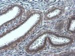 Phospho-EGFR (Tyr845) Antibody in Immunohistochemistry (Paraffin) (IHC (P))