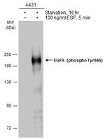 Phospho-EGFR (Tyr845) Antibody in Western Blot (WB)