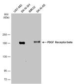 PDGFRB Antibody in Western Blot (WB)