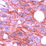 ErbB4 Antibody in Immunohistochemistry (Paraffin) (IHC (P))