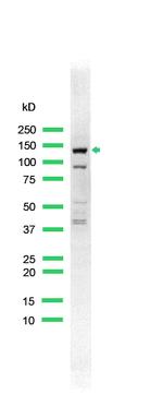 ErbB4 Antibody in Western Blot (WB)