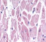 HIF-2 alpha Antibody in Immunohistochemistry (IHC)