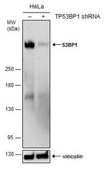 53BP1 Antibody