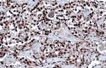 53BP1 Antibody in Immunohistochemistry (Paraffin) (IHC (P))